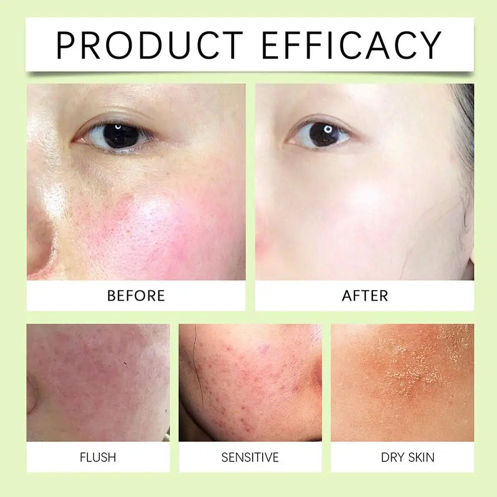 Soothing Moisturising Facial Gel