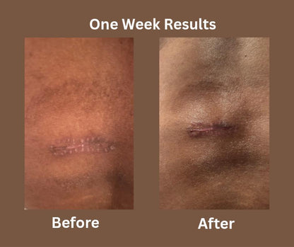 Sacred Skin Salve